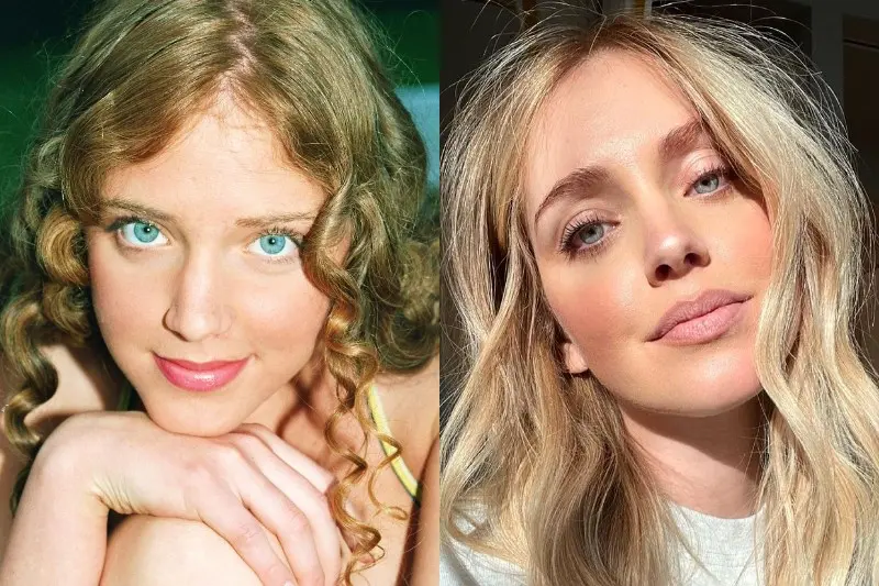 Chiara Franius prije i poslije plastike