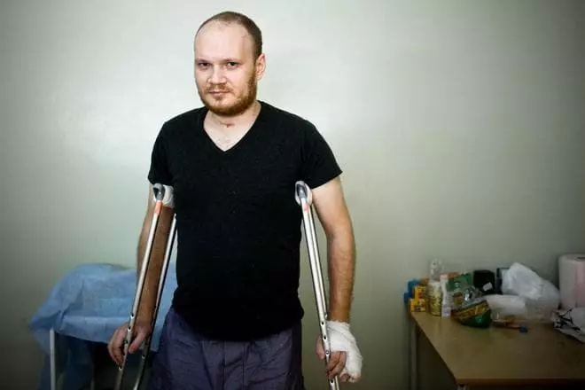 Oleg Kashin u bolnici