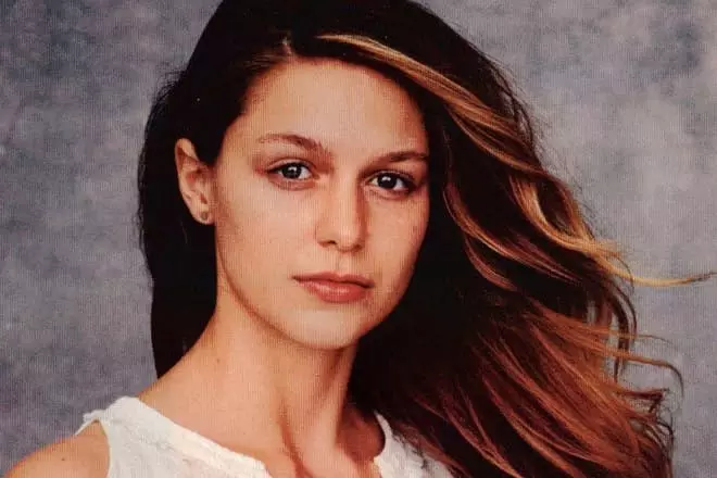 Melissa Benoist senza trucco