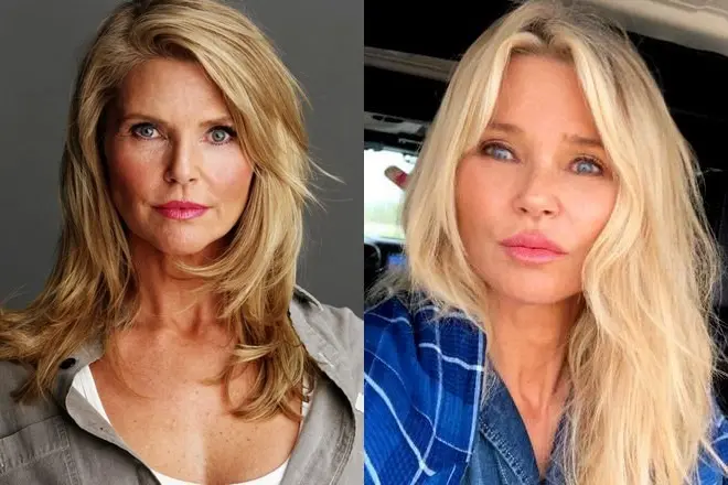 Christie Brinkley înainte și după plastic