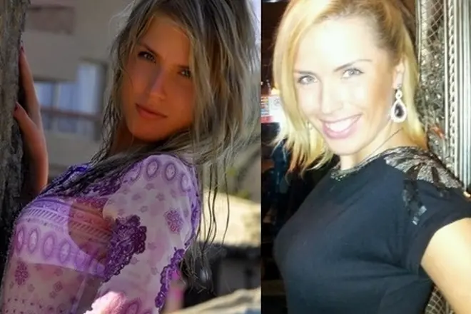 Oxana Rye före och efter plast