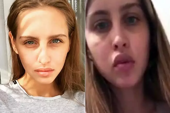 Anastasia Kiushushina avant et après le plastique