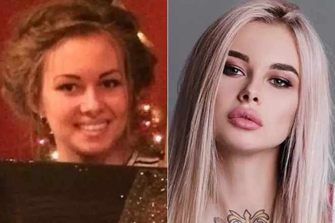 Elena Chromine antes e depois dos plásticos