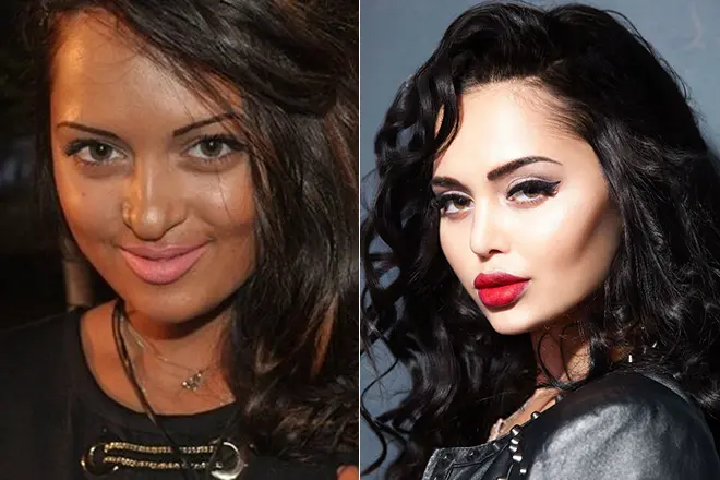 Nita Kuzmina before and after plastic