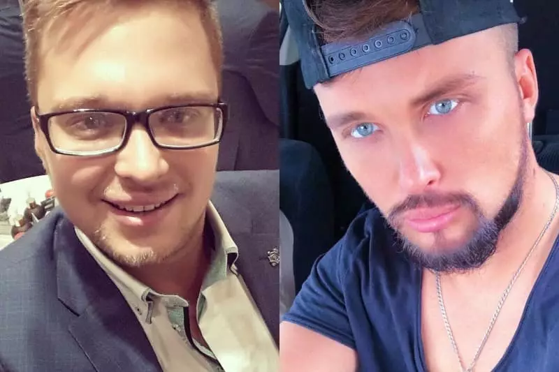 Egor Halyavin prije i nakon plastike
