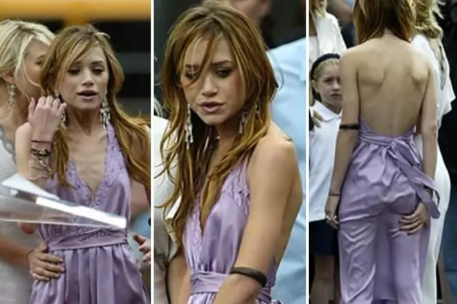 Mary Kate Olsen suffered anorexia