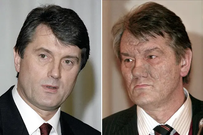 Viktor Yushchenko zaharlanishdan oldin va keyin