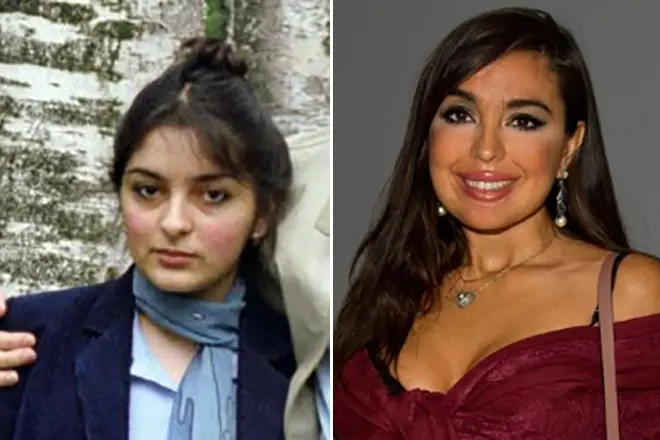 Leila Aliyev abans i després de plàstics
