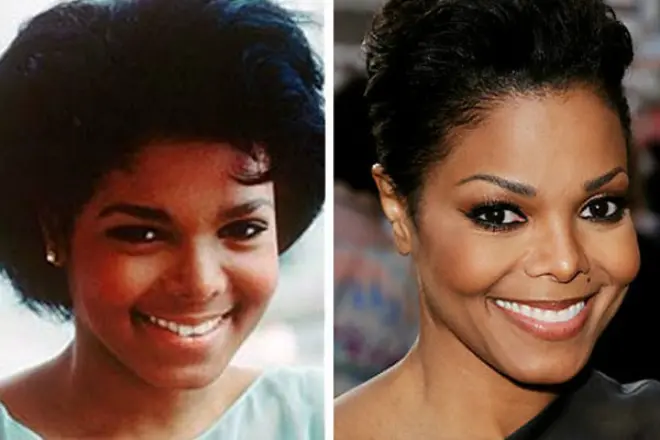 Janet Jackson to Riplasty and after