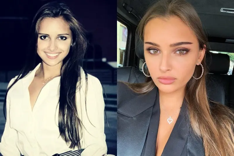 Carolina Sevastastanova vor und nach dem Kunststoff
