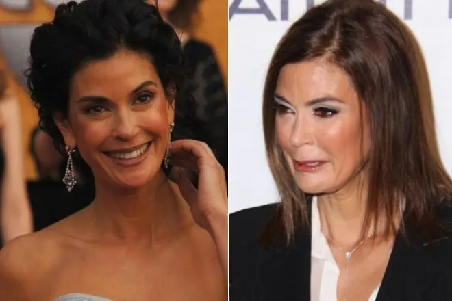 Teri Hatcher before and after plastic