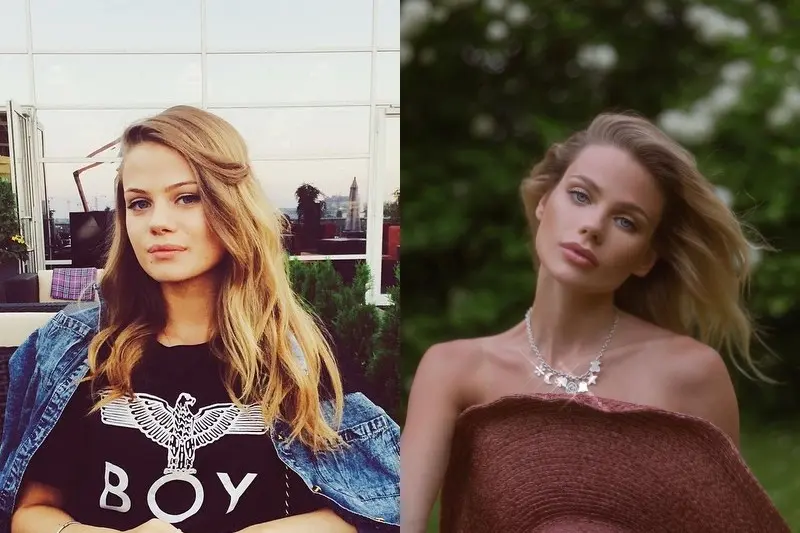 Alena Krasnova avant et après le plastique