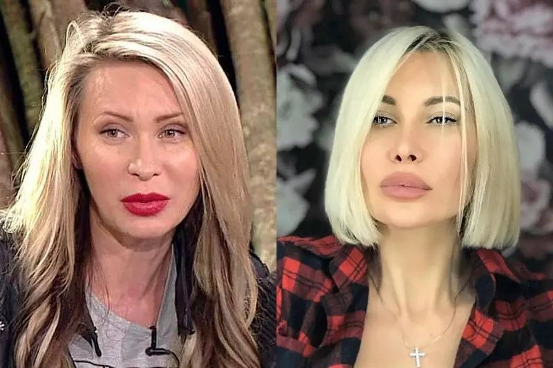 Elina Kamiren before and after plastics