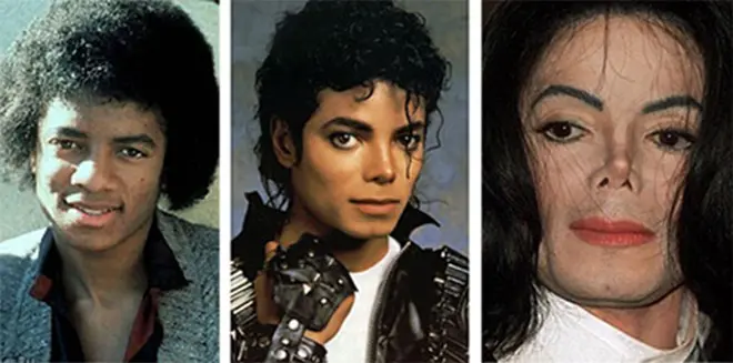 Пластикалық операциялар Майкл Джексон (дейін және кейін)