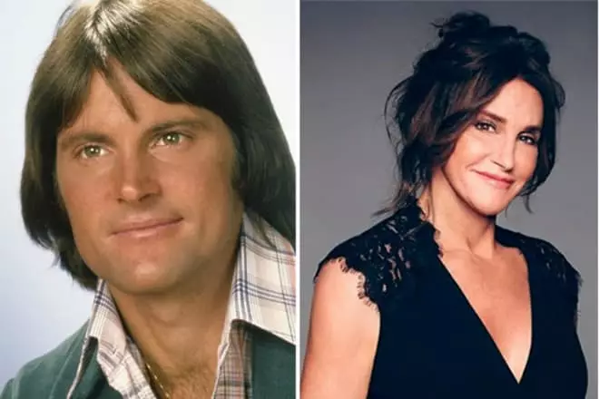 Keitlin Jenner pred in po operaciji