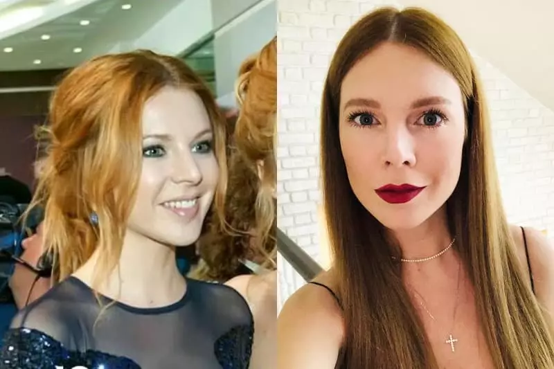 Natalia Podolskaya antes y después de la rinoplastia