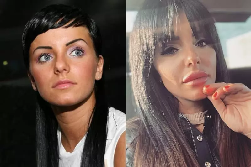 Julia Volkova antes e depois de plástico