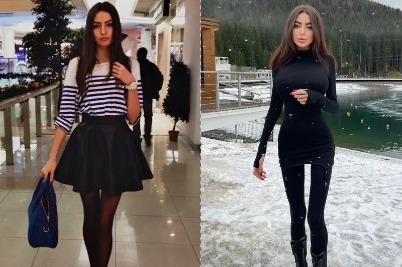 Alena Omovici înainte și după plastic