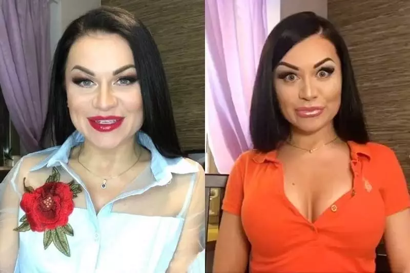Evgenia Diduil sebelum dan selepas plastik