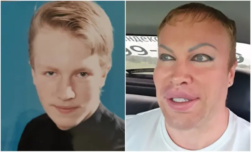 Alexander SHPAK antes y después de las aficiones