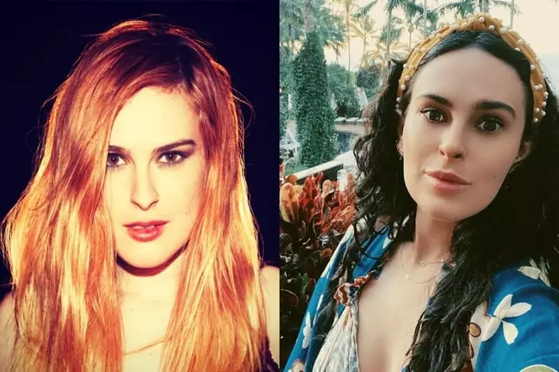 Rumer Willis before and after plastic
