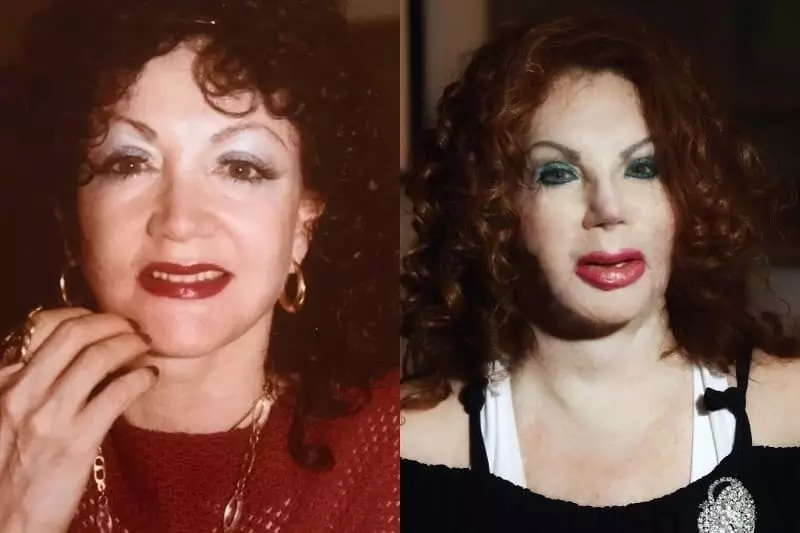 Jacqueline Stallone antes e despois do plástico