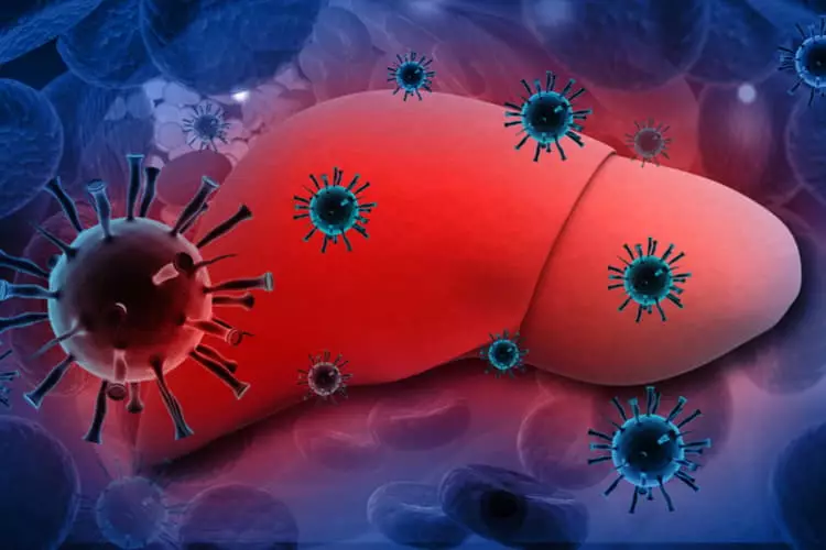 Hepatitis C: Simptome en tekens